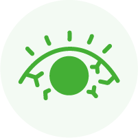 アレルギー性結膜炎